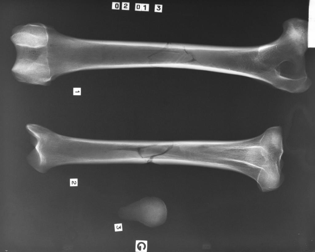 Radiographie des humérus, radius et ulna gauches (cliché : R.