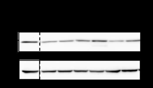 A B Figure 6 : Niveaux d expression des protéines BAK et BAX dans les HCT-116 transfectées Les cellules HCT-116 adhérées au pétri ont été transfectées avec différents DsiRNA afin d obtenir la plus