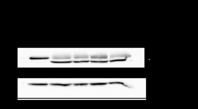 Figure 10 : Résistance à l apoptose par l observation du clivage in cellulo de PARP- 1 dans les cellules HCT-116 surexprimant BCL-XL et XIAP exposées au TRAIL Les cellules