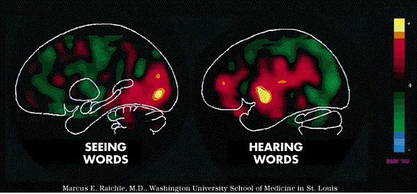 Étude du fonctionnement du cerveau Lecture Écoute La lecture et l écoute ne font pas travailler les mêmes zones du cerveau CNRS-IN2P3 et CEA-DSM-DAPNIA -T15 Par TEP avec du FluoroDesoxyGlucose (FDG)