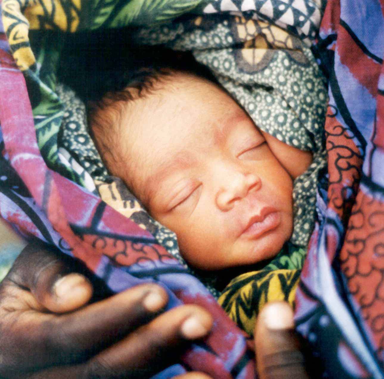 Donnons sa chance à chaque nouveau-né de l'afrique Soins néonatals