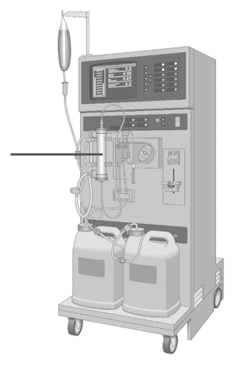 figure 1 a. b. Dialyseur Représentation de l hémodialyse et de la dialyse péritonéale Appareil d hémodialyse Cavité péritonéale envisagé.