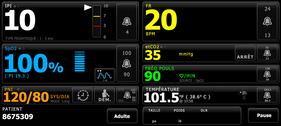 Mode d emploi Navigation 45 Dans le profil Monitorage continu, les données des mesures patient sont automatiquement enregistrées dans l'onglet Revue.