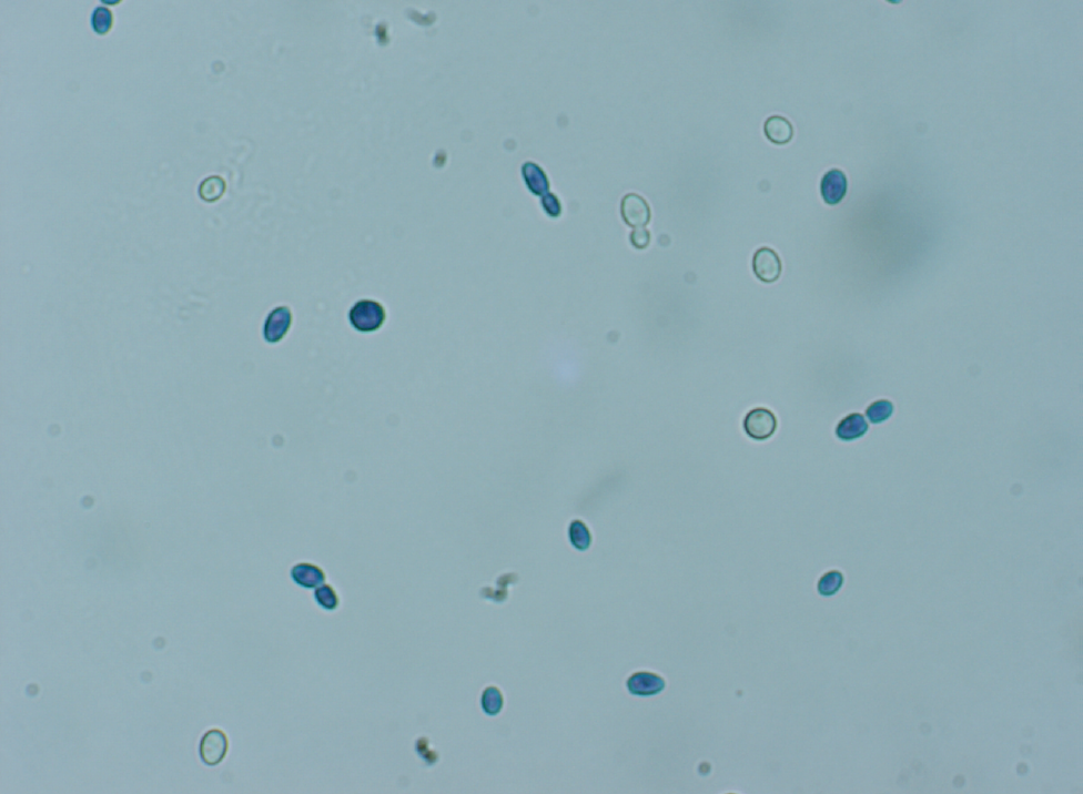 Partie IV Au cours de l avancement de la fermentation alcoolique, nous observons une augmentation de la proportion de cellules colorées en bleu par le bleu de méthylène (cf. figure 31).