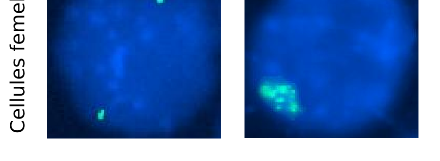 Panneaux du milieu et du bas: Marquage par RNAFISH (en vert) des ARN issus du locus Xist/Tsix. Les noyaux sont colorés en bleu au DAPI. À gauche: cellules indifférenciées.