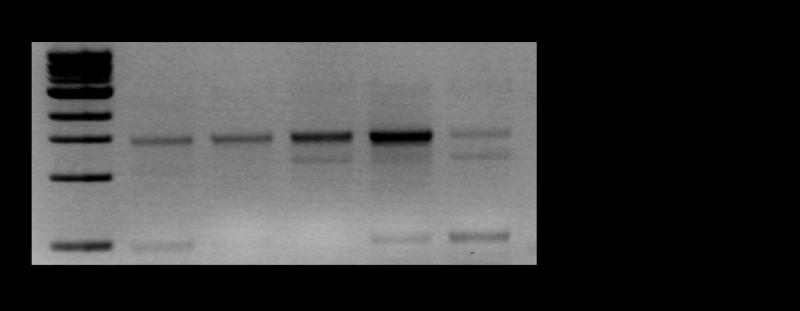 RESULTATS Figure 27 : Isoformes issues d épissage alternatif du transcrit OTP43. A. PCR sur ADNc avec les amorces «Start» et «Stop» correspondants à OTP43. B.
