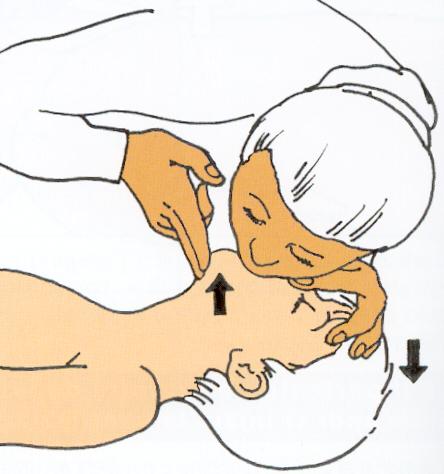 Ventilation 5 insufflations initiales: Chez l enfant de moins de 1 an: bouche à bouche-nez.