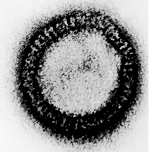 Virus «enveloppé enveloppés» Les virus «nus» Virus de la rage Adé Adénovirus Virus de la grippe Complexe