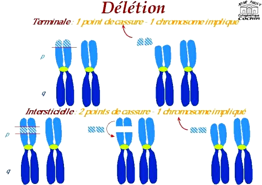 A noter que del (5q) et del (7q) correspondent à la délétion entière du bras long des chromosomes 5 et 7 respectivement.