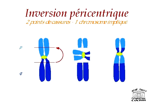 4.2.4. Le chromosome isodicentrique Un chromosome isodicentrique (idic) est un iso chromosome avec deux copies du centromère. Les chromosomes isodicentriques sont rares. Un exemple est idic (7p) (77).