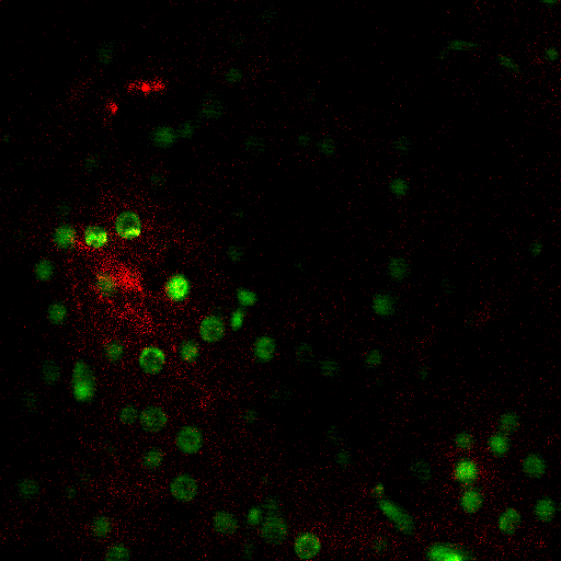 La microscopie confocale Conditions expérimentales Améliorations du modèle 3D Noyaux cellulaires (Sytox Green), cytoplasmes (Rhodamine Phalloidin), Des coupes
