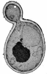 Assier de Pompignan Cassandre Figure 2 : Photographie au MET de levures en cour et en fin de bourgeonnement. On observe de nombreuses cicatrices sur les cellules, dues à la séparation des cellules.