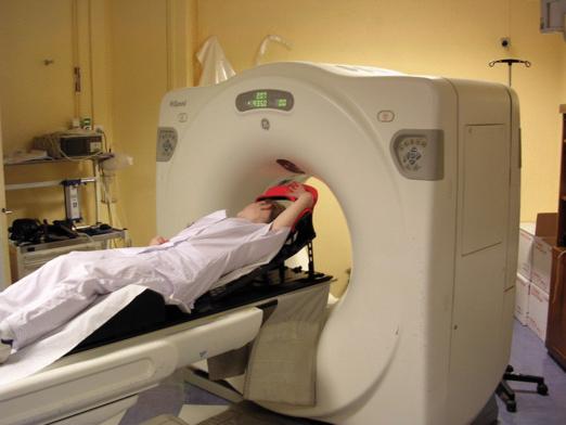 21 Le parcours du patient en Radiothérapie Diagnostic du cancer Choix du traitement thérapeutique Scanner de simulation Délinéation tumeur et OAR Choix de la balistique