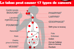 Poids du tabac dans les cancers o Le tabac : 1 er facteur de risque de cancer