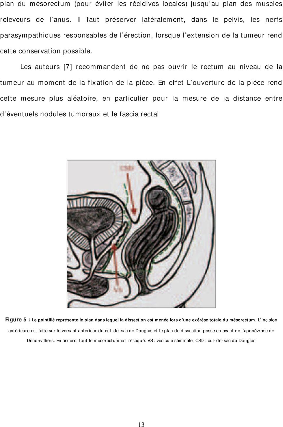 Les auteurs [7] recommandent de ne pas ouvrir le rectum au niveau de la tumeur au moment de la fixation de la pièce.