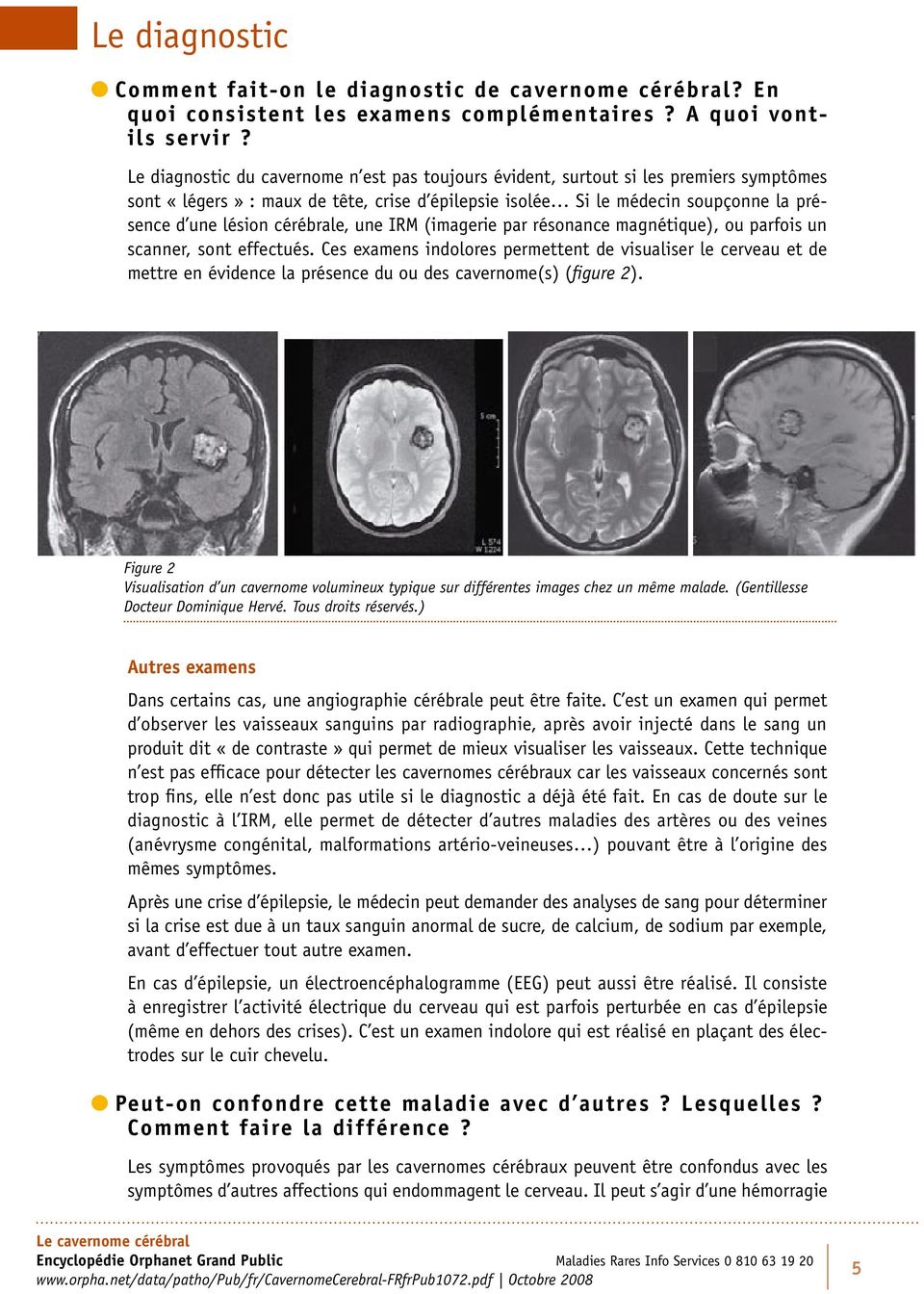 cérébrale, une IRM (imagerie par résonance magnétique), ou parfois un scanner, sont effectués.