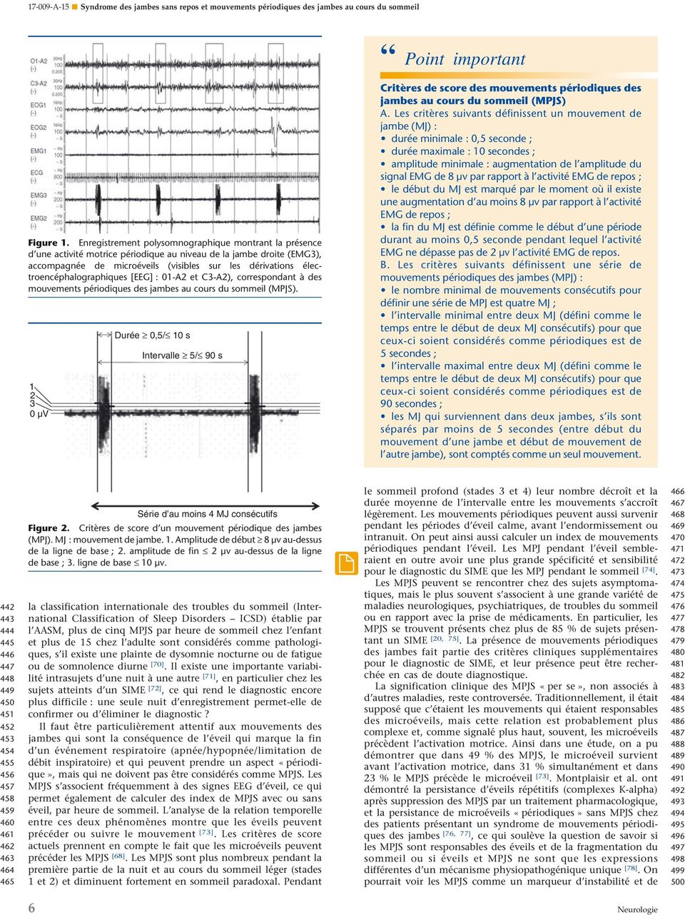 électroencéphalographiques [EEG] : 01-A2 et C3-A2), correspondant à des mouvements périodiques des jambes au cours du sommeil (MPJS).