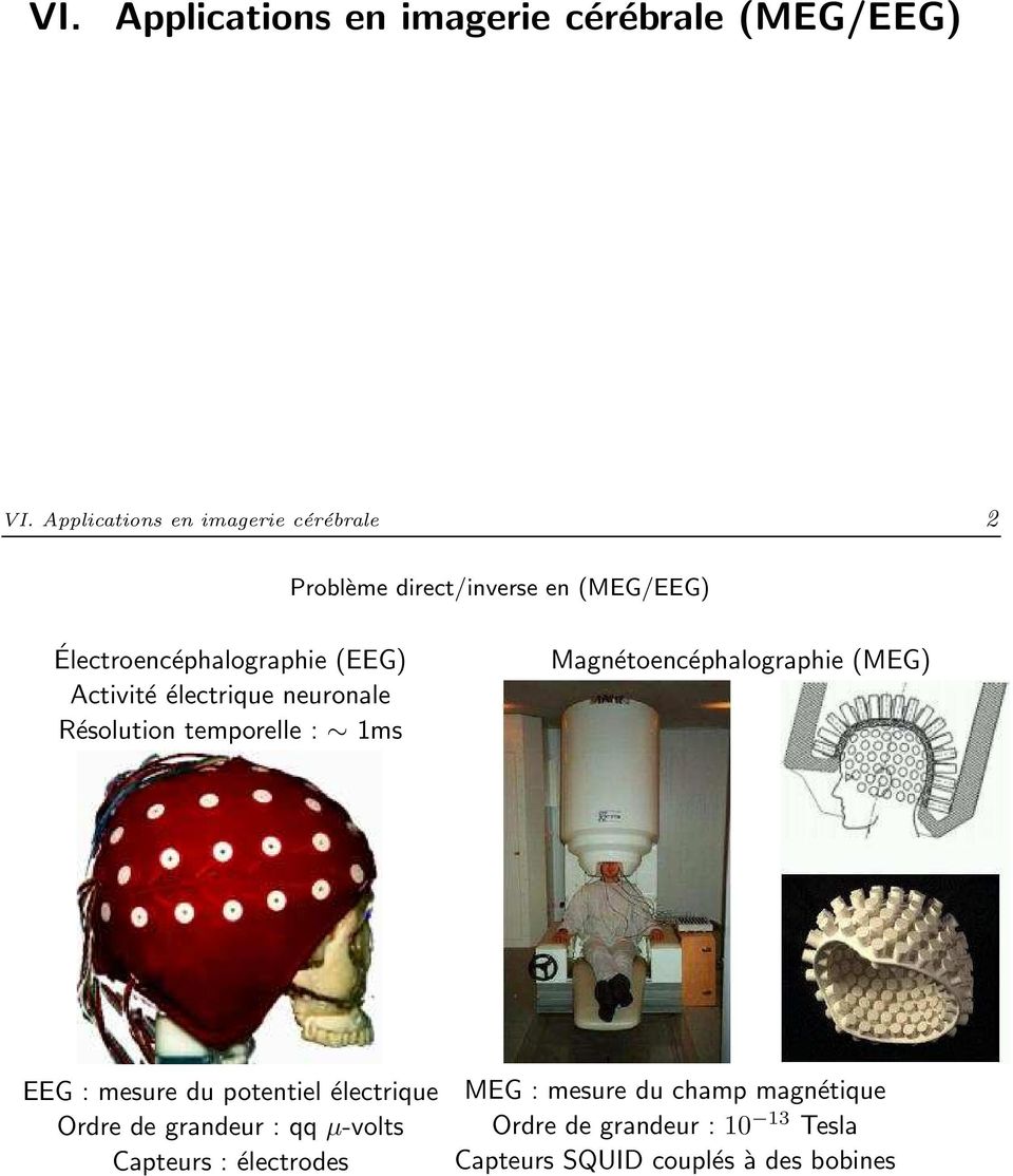 Applications en imagerie cérébrale (MEG/EEG) VI.