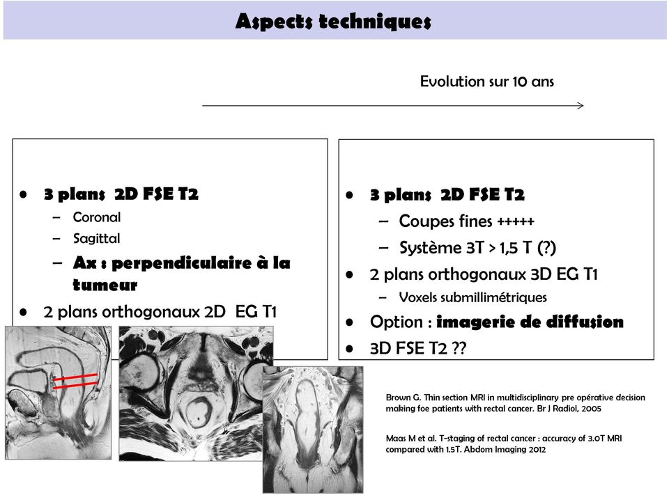 ) 2 plans orthogonaux 3D EG T1 Voxels submillimétriques Option : imagerie de diffusion 3D FSE T2?? Brown G.