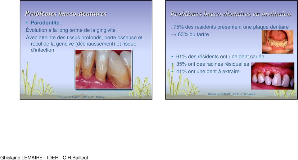Problèmes bucco-dentaires en institution (1) 75% des résidents présentent une plaque dentaire 63%