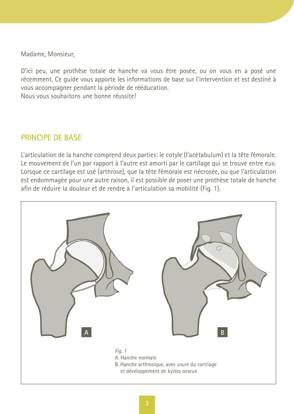Principe de base L articulation de la hanche comprend deux parties: le cotyle (l acétabulum) et la tête fémorale.