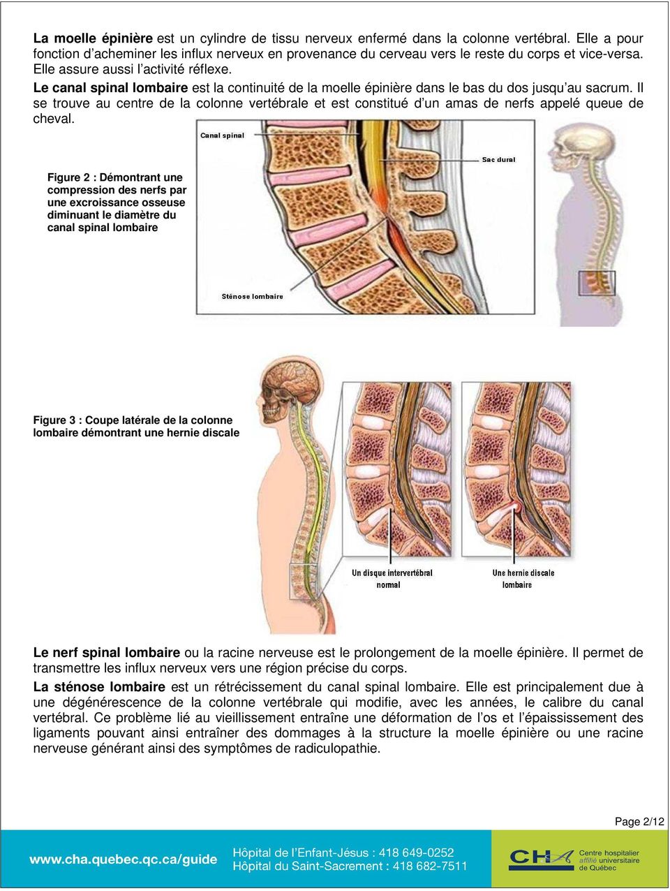 Le canal spinal lombaire est la continuité de la moelle épinière dans le bas du dos jusqu au sacrum.
