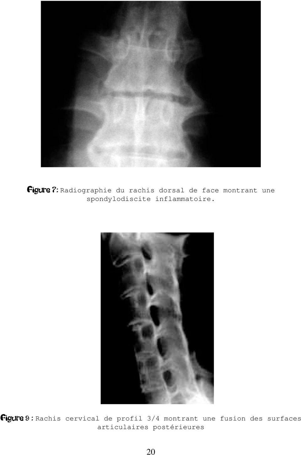 Figure 9 : Rachis cervical de profil 3/4