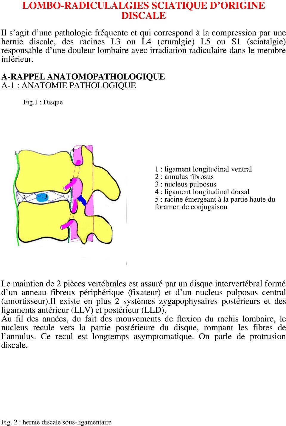 1 : Disque 1 : ligament longitudinal ventral 2 : annulus fibrosus 3 : nucleus pulposus 4 : ligament longitudinal dorsal 5 : racine émergeant à la partie haute du foramen de conjugaison Le maintien de