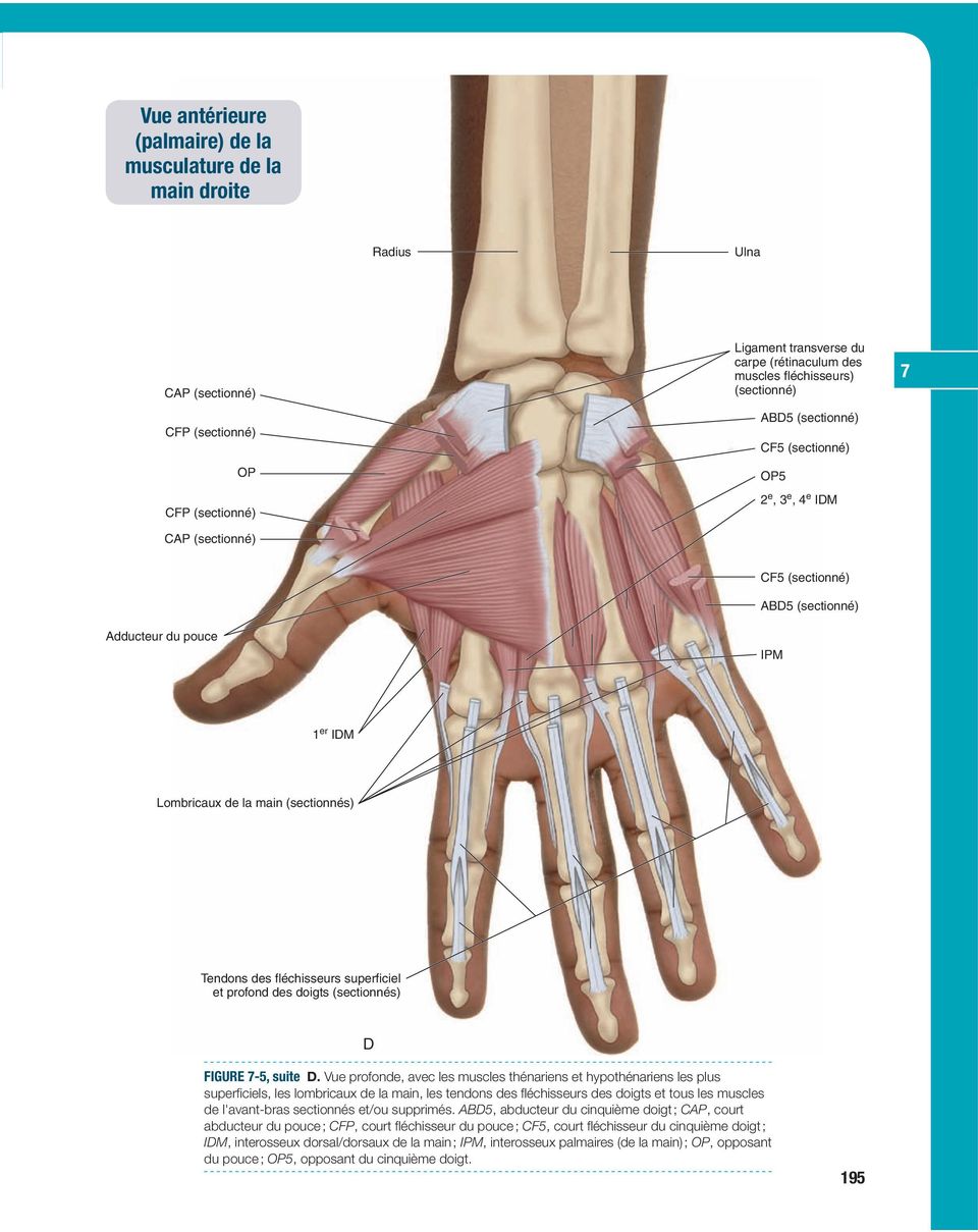 Lombricaux de la main (sectionnés) Tendons des fléchisseurs superficiel et profond des doigts (sectionnés) D FIGURE -5, suite D.