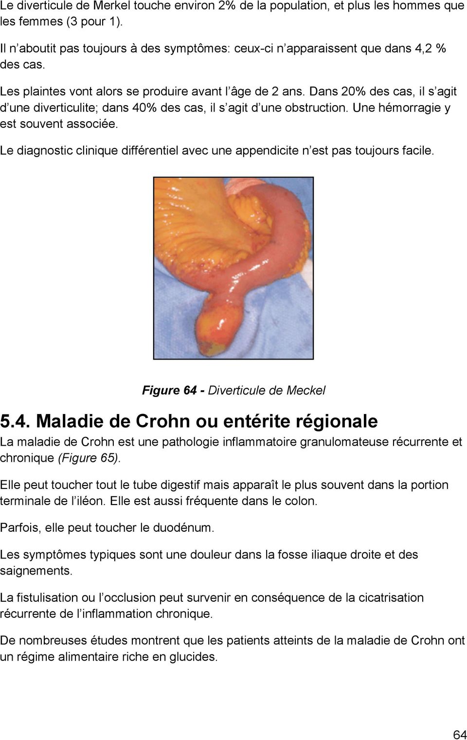 Le diagnostic clinique différentiel avec une appendicite n est pas toujours facile. Figure 64 