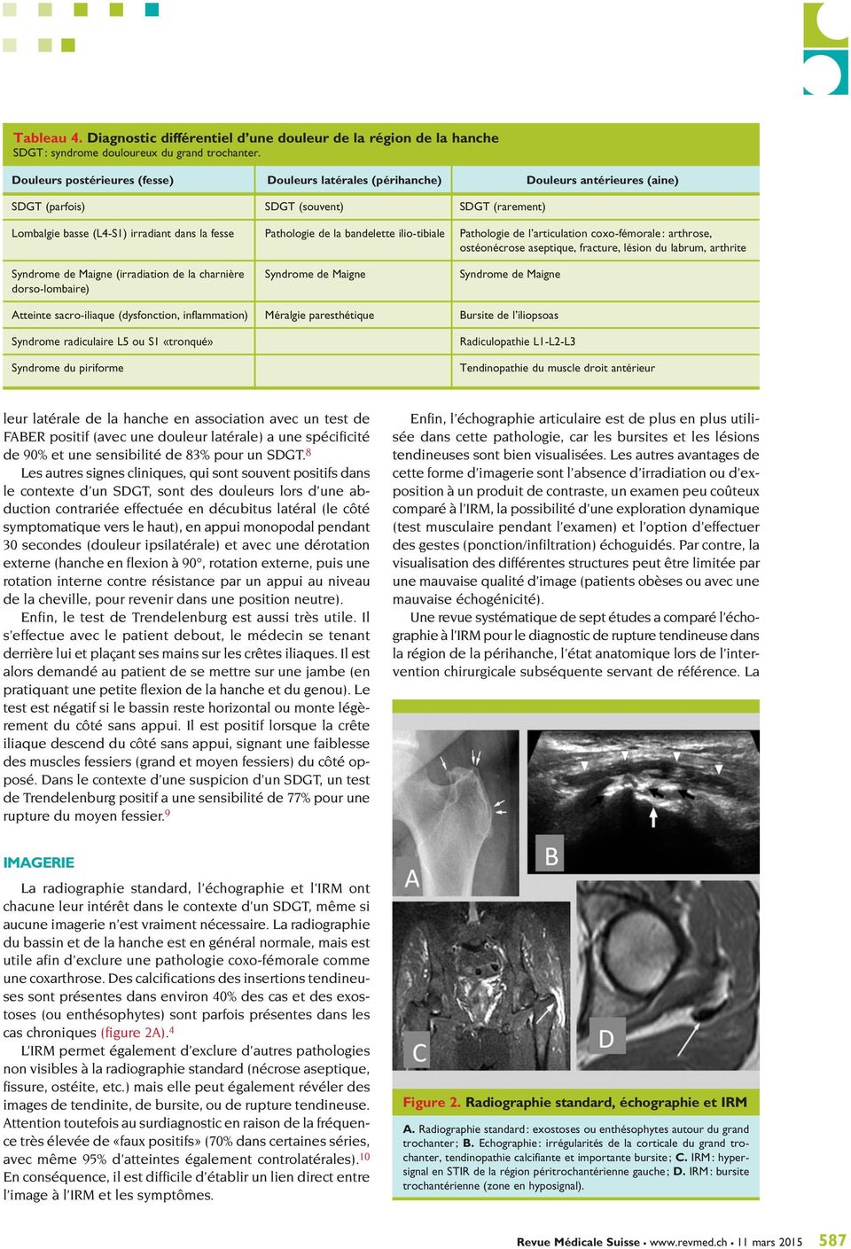 la bandelette ilio-tibiale Pathologie de l articulation coxo-fémorale : arthrose, ostéonécrose aseptique, fracture, lésion du labrum, arthrite Syndrome de Maigne (irradiation de la charnière Syndrome