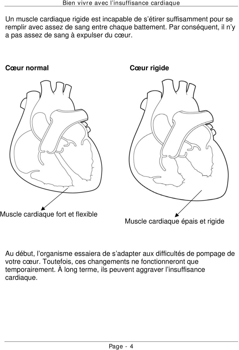 Cœur normal Cœur rigide Muscle cardiaque fort et flexible Muscle cardiaque épais et rigide Au début, l organisme essaiera de