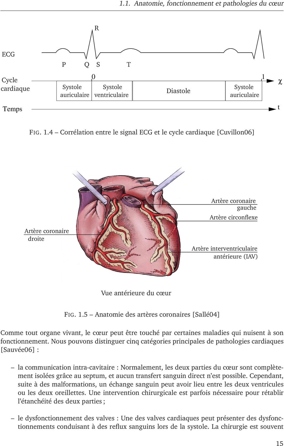 4 Corrélation entre le signal ECG et le cycle cardiaque [Cuvillon06] Artère coronaire gauche Artère circonflexe Artère coronaire droite Artère interventriculaire antérieure (IAV) Vue antérieure du