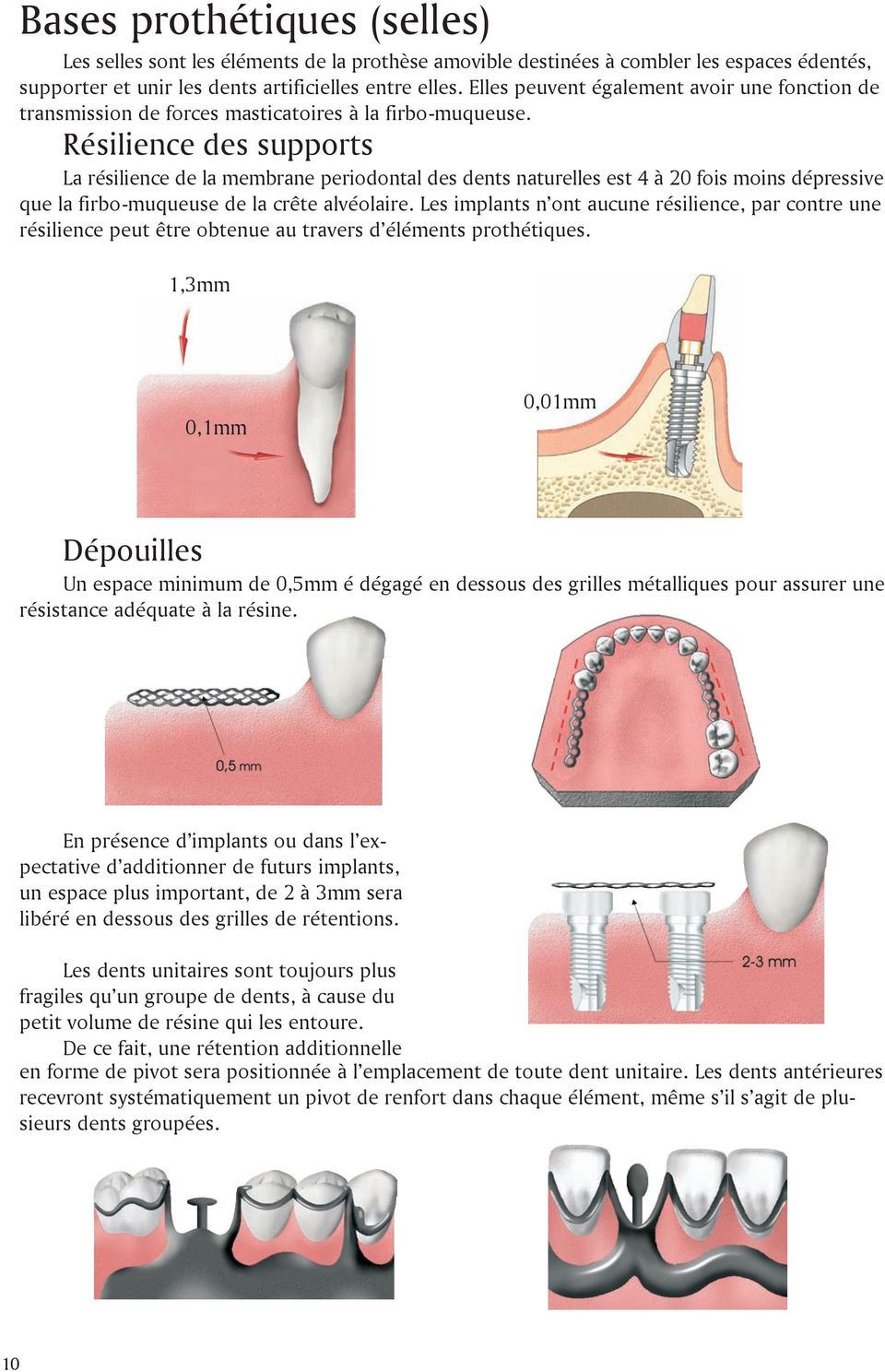 Résilience des supports La résilience de la membrane periodontal des dents naturelles est 4 à 20 fois moins dépressive que la firbo-muqueuse de la crête alvéolaire.