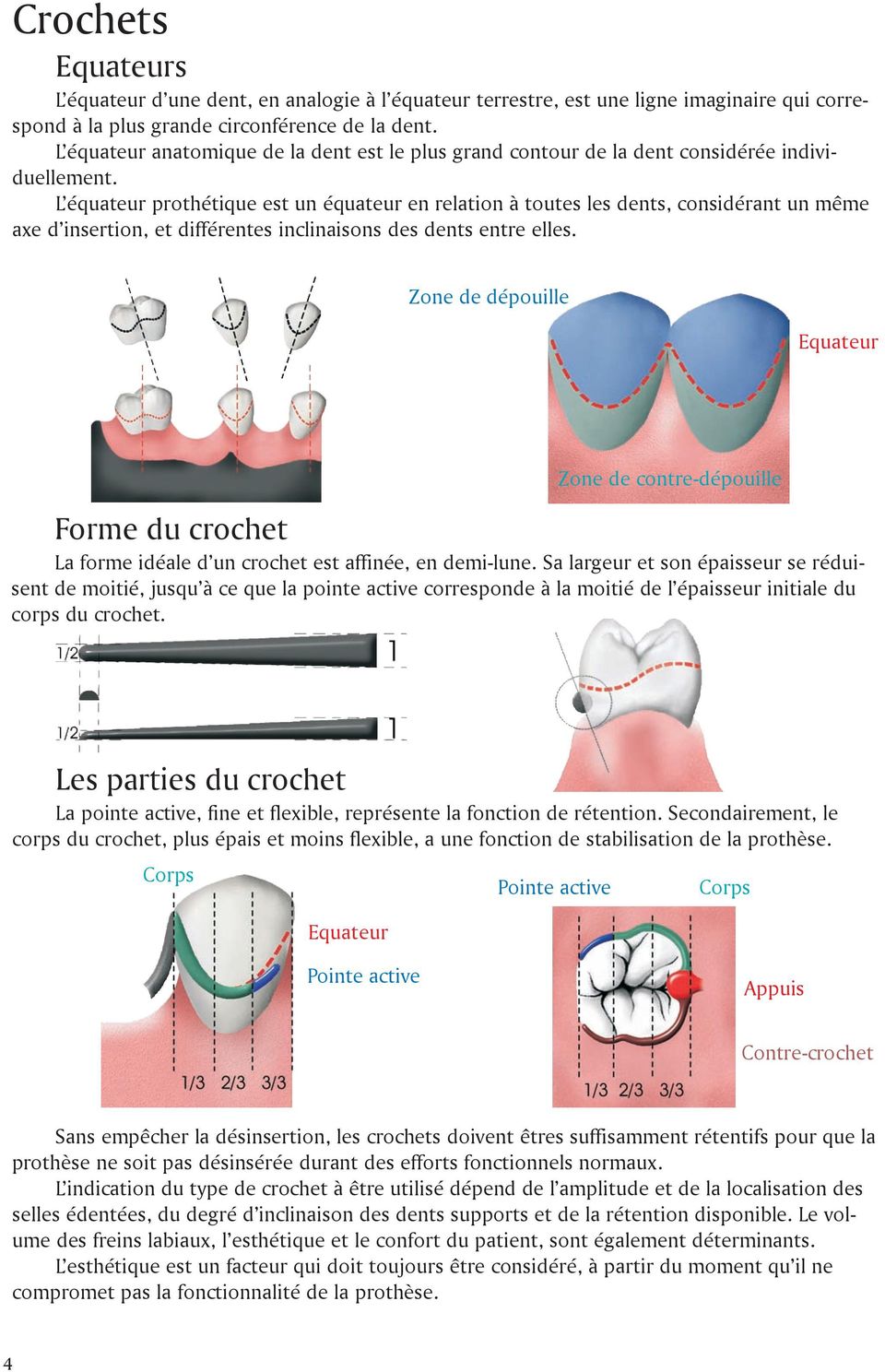 L équateur prothétique est un équateur en relation à toutes les dents, considérant un même axe d insertion, et différentes inclinaisons des dents entre elles.