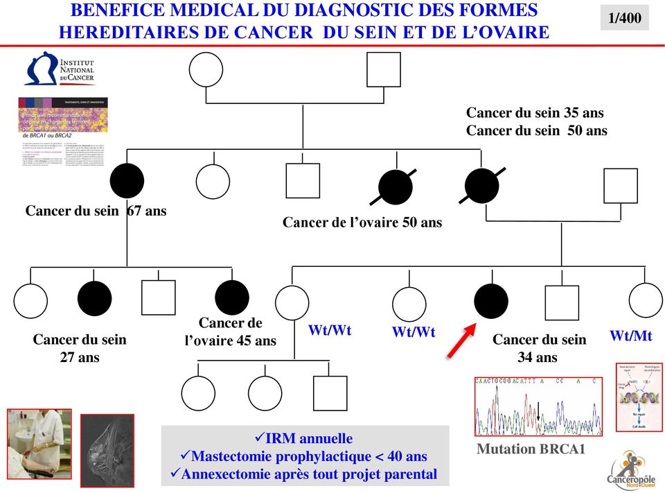 Cancer du sein 27 ans Cancer de l ovaire 45 ans Wt/Wt Wt/Wt Cancer du sein Wt/Mt 34 ans IRM