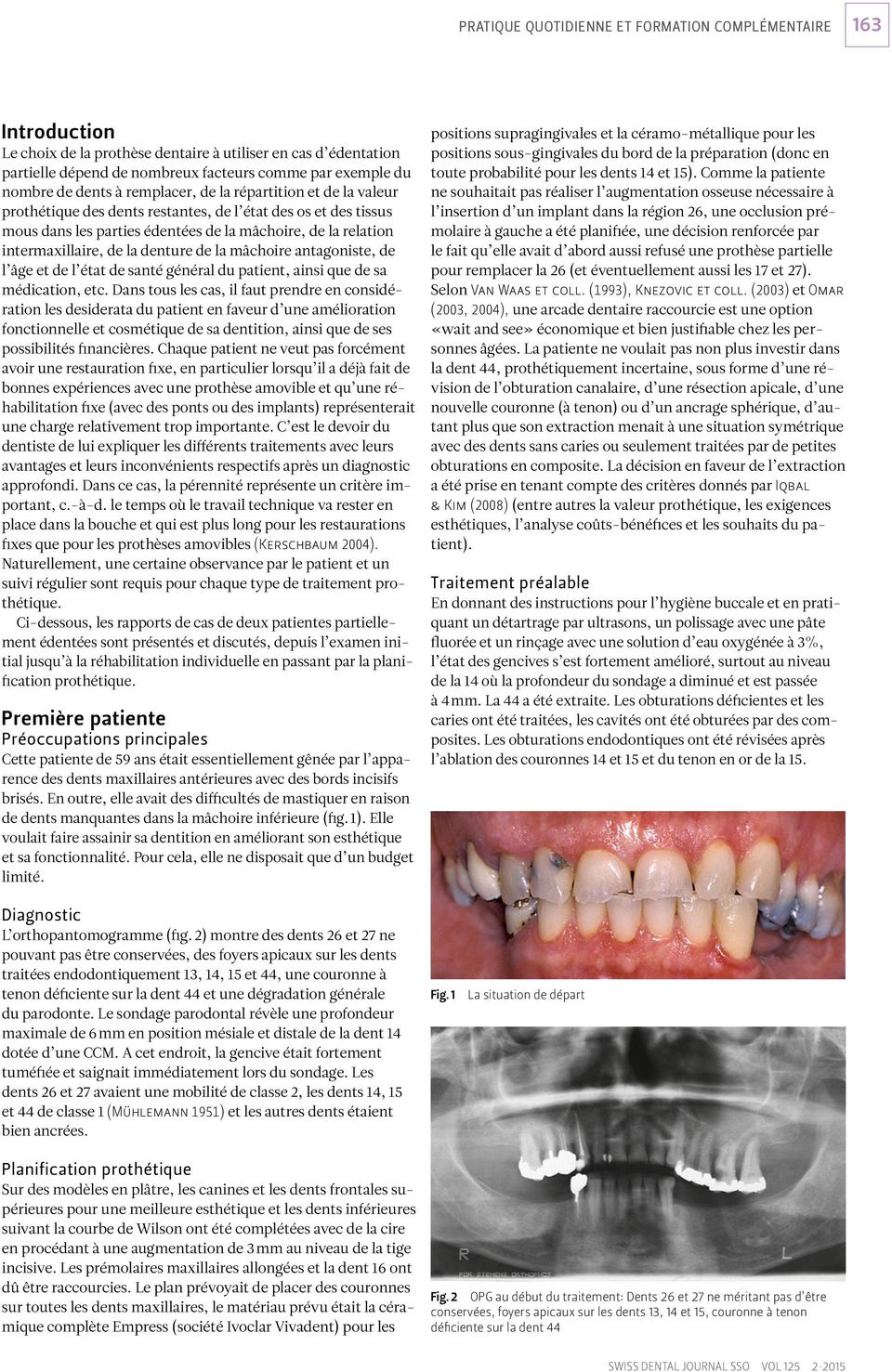 la denture de la mâchoire antagoniste, de l âge et de l état de santé général du patient, ainsi que de sa médication, etc.