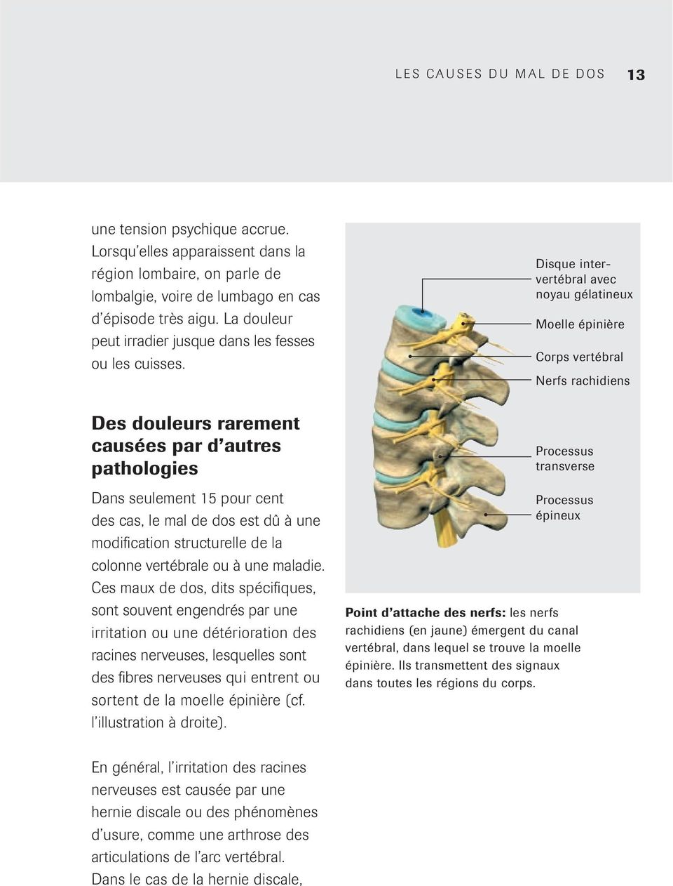 Des douleurs rarement causées par d autres pathologies Dans seulement 15 pour cent des cas, le mal de dos est dû à une modification structurelle de la colonne vertébrale ou à une maladie.