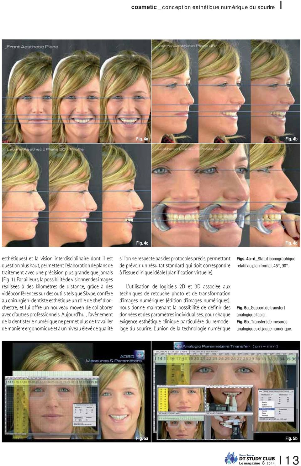 Par ailleurs, la possibilité de visionner des images réalisées à des kilomètres de distance, grâce à des vidéoconférences sur des outils tels que Skype, confère au chirurgien-dentiste esthétique un