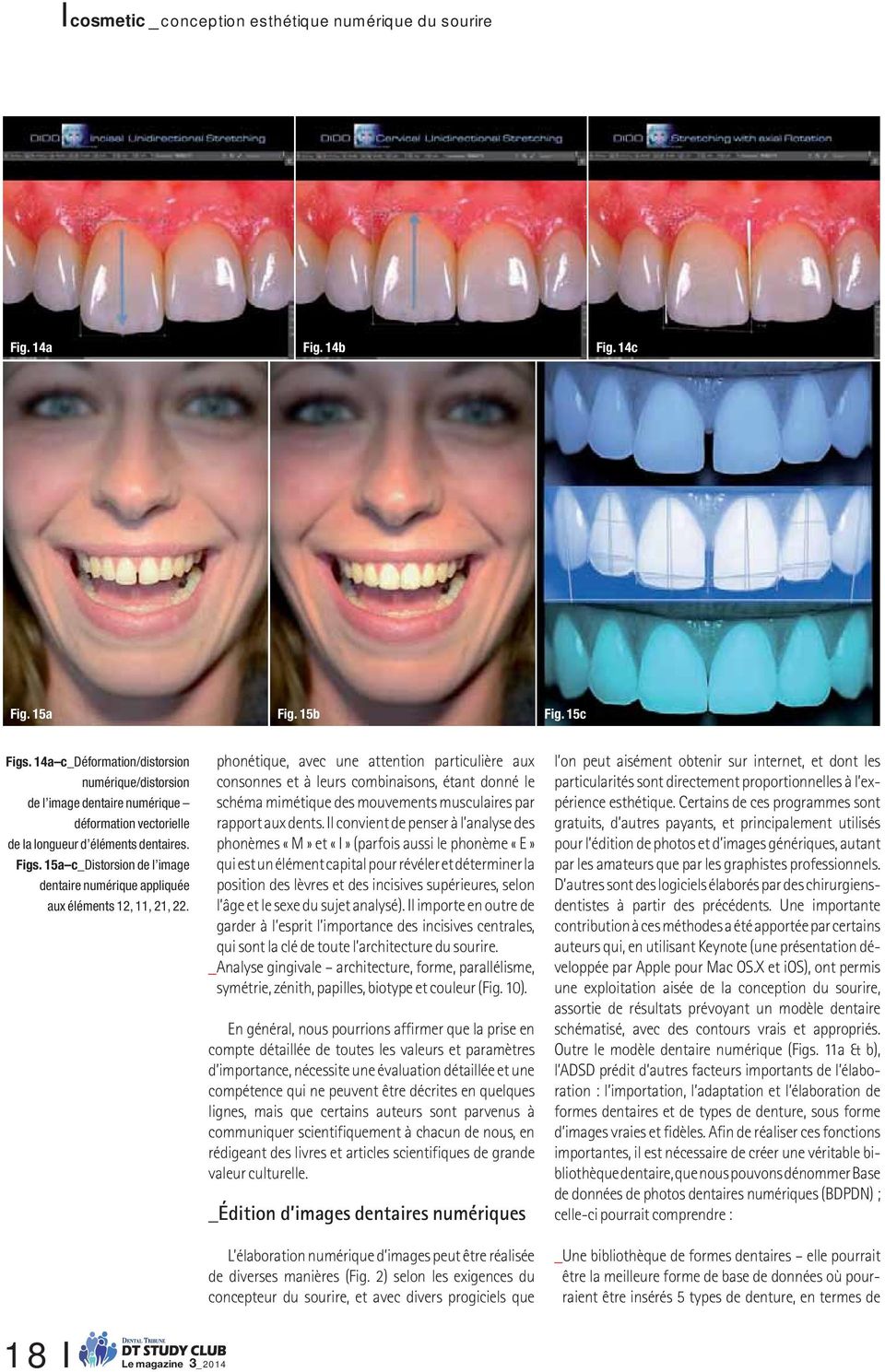 15a c_distorsion de l image dentaire numérique appliquée aux éléments 12, 11, 21, 22.
