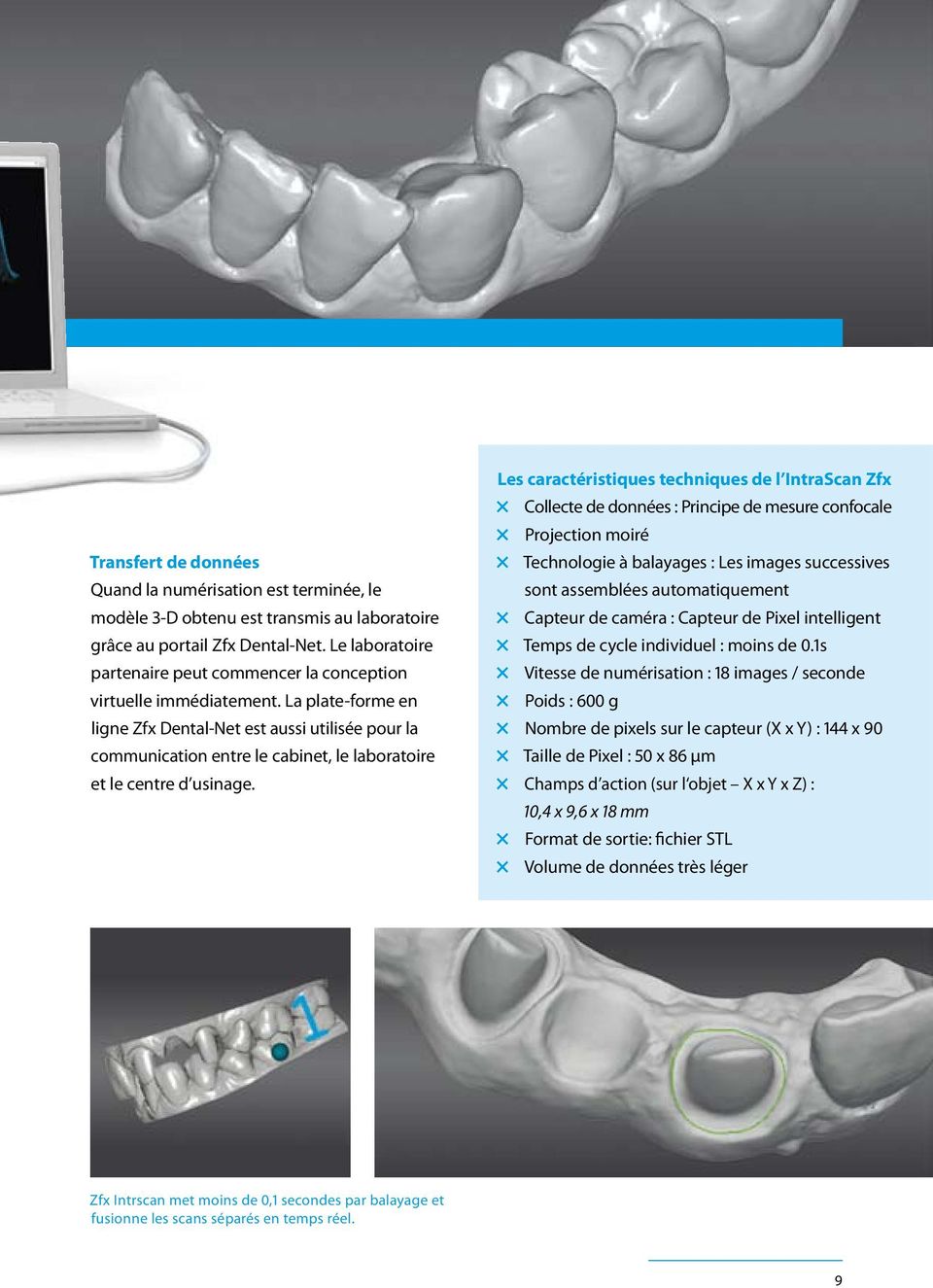 La plate-forme en ligne Zfx Dental-Net est aussi utilisée pour la communication entre le cabinet, le laboratoire et le centre d usinage.