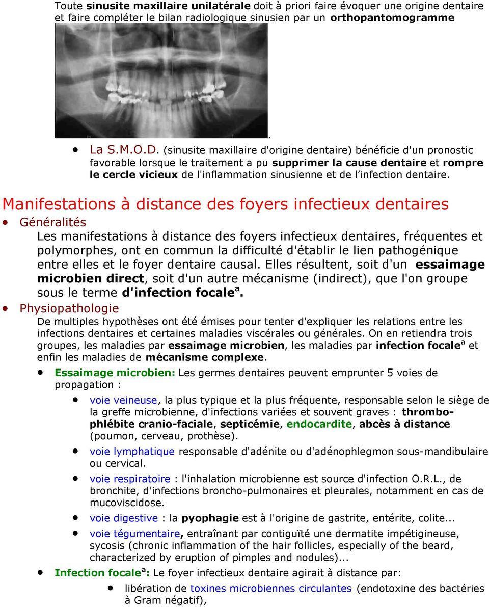 infection dentaire.