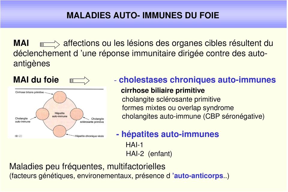 cholangite sclérosante primitive formes mixtes ou overlap syndrome cholangites auto-immune (CBP séronégative) - hépatites