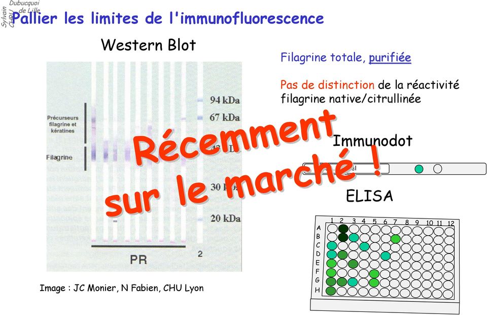filagrine native/citrullinée Immunodot Dup Michel ELISA Image :