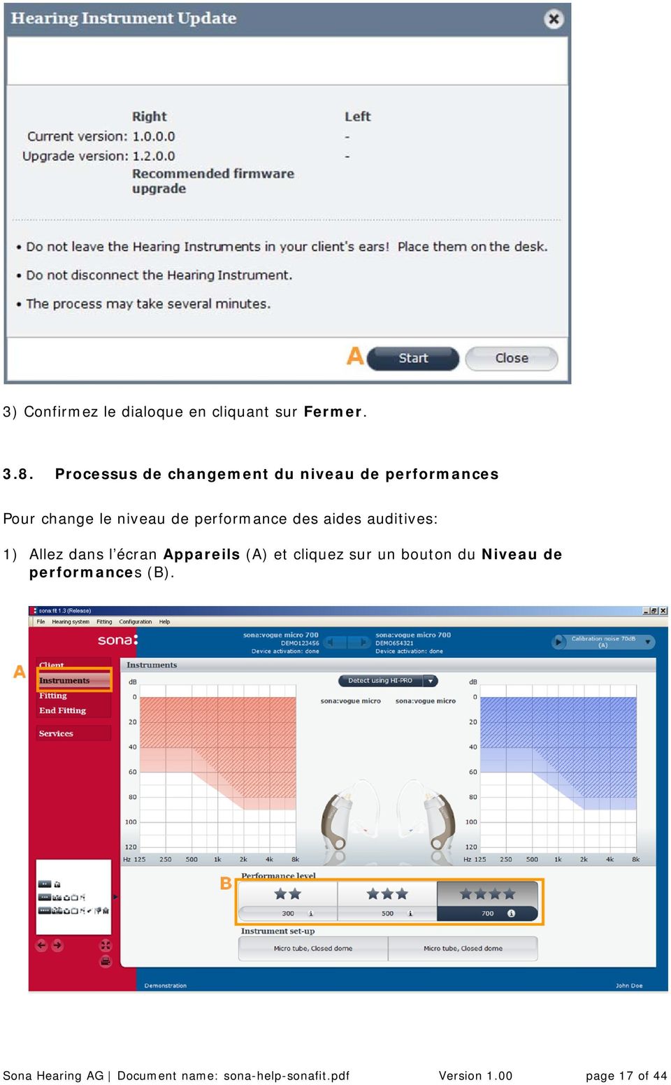 performance des aides auditives: 1) Allez dans l écran Appareils (A) et cliquez sur