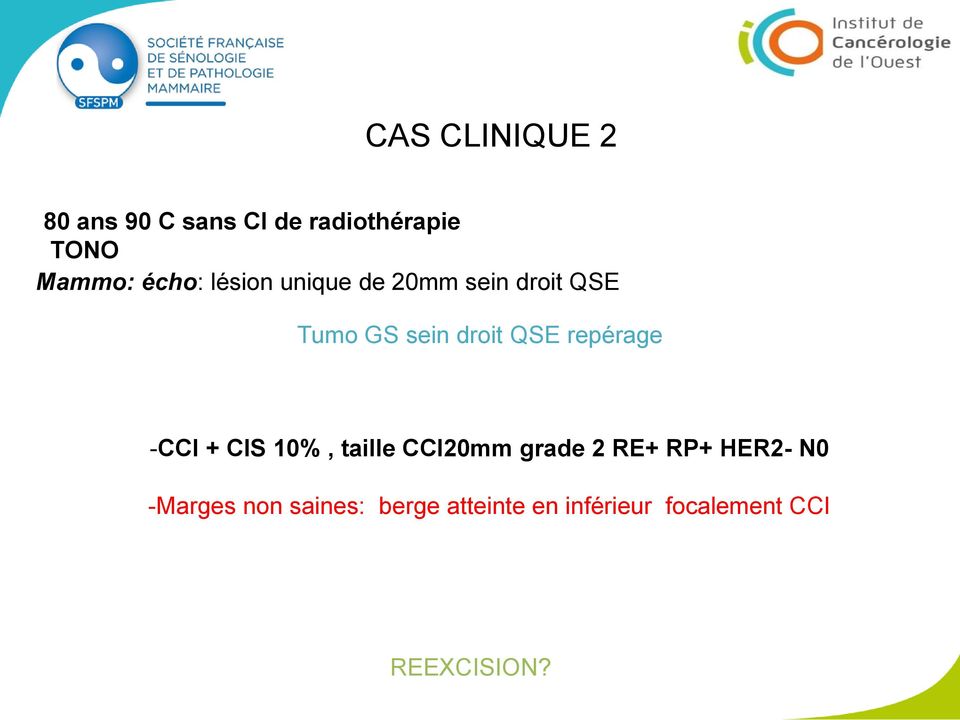 repérage -CCI + CIS 10%, taille CCI20mm grade 2 RE+ RP+ HER2- N0