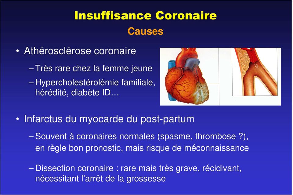 Souvent à coronaires normales (spasme, thrombose?