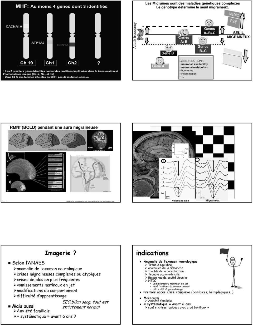 RMNf (BOLD) pendant une aura migraineuse Olesen J et al. Ann Neurol. 1990.