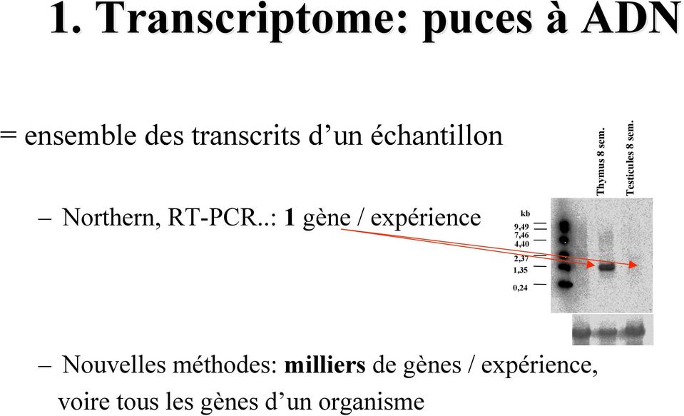 échantillon Northern, RT-PCR.