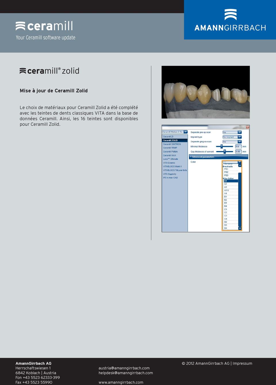 dents classiques VITA dans la base de données Ceramill.